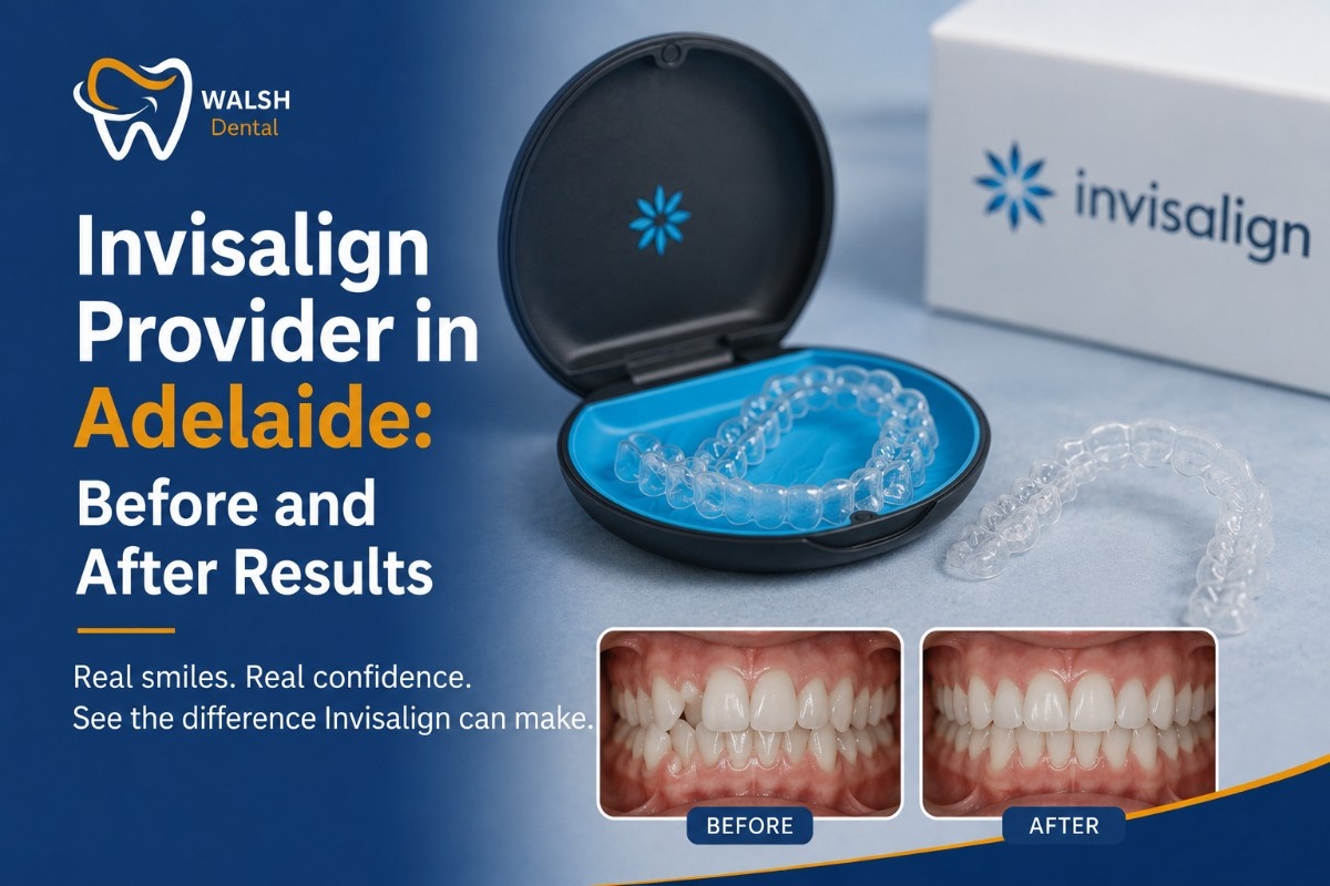 Invisalign Provider in Adelaide